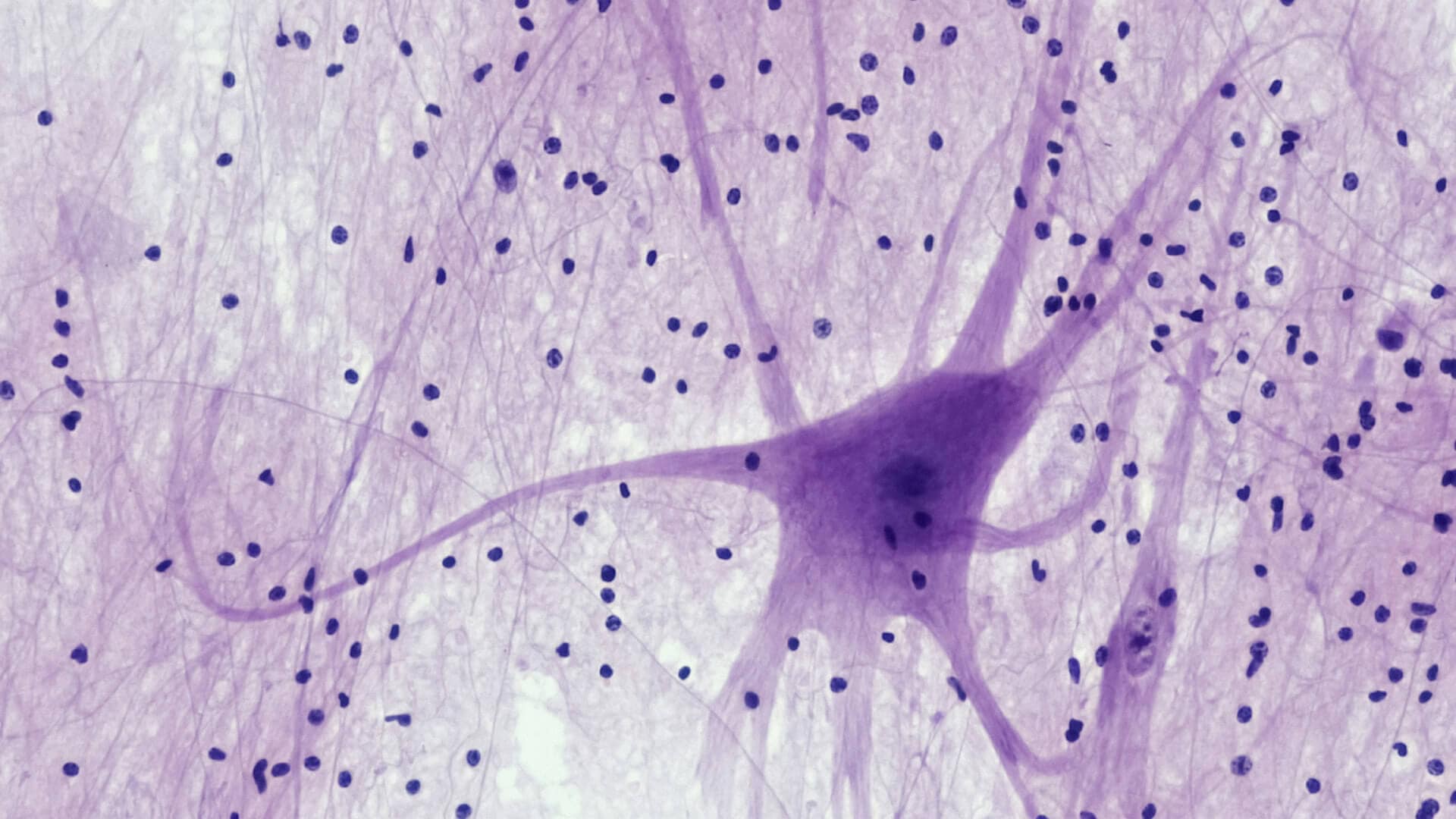 Kavin Mistry explains stress and anxiety brain fog